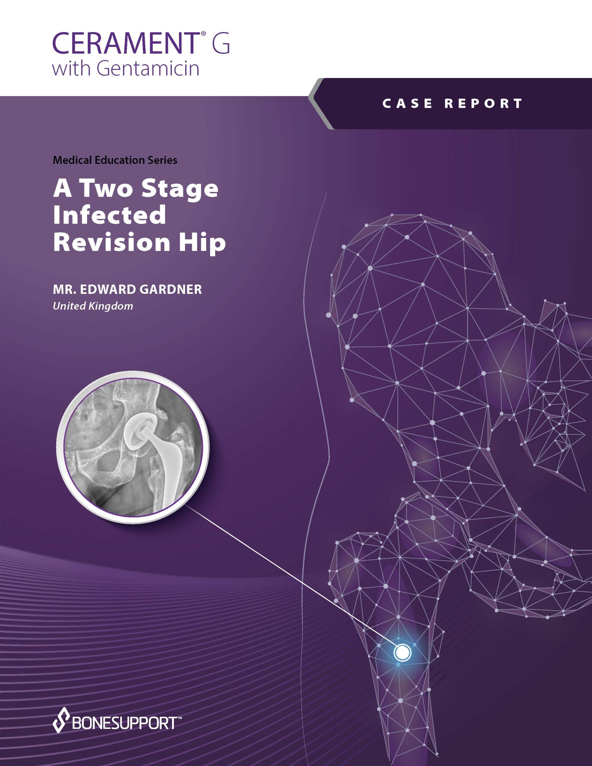 Mr. Gardner CERAMENT G in a two-stage infected hip