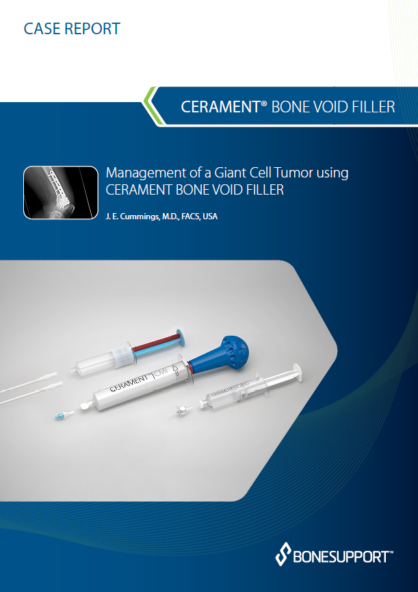 Cummings Management of a Giant Cell Tumor using CERAMENT BONE VOID FILLER