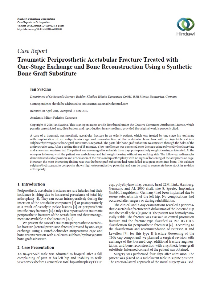 Traumatic periprosthetic acetabular fracture treated with one-stage exchange and bone reconstruction using a synthetic bone graft substitute