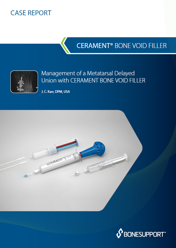 Management of a metatarsal delayed union with CERAMENT® BONE VOID FILLER