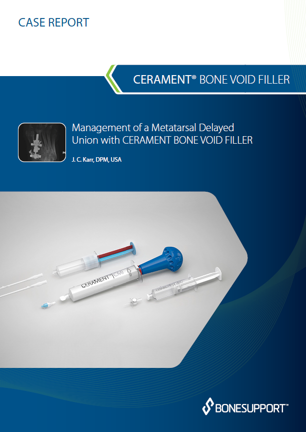 Karr Management of a metatarsal delayed union with CBVF