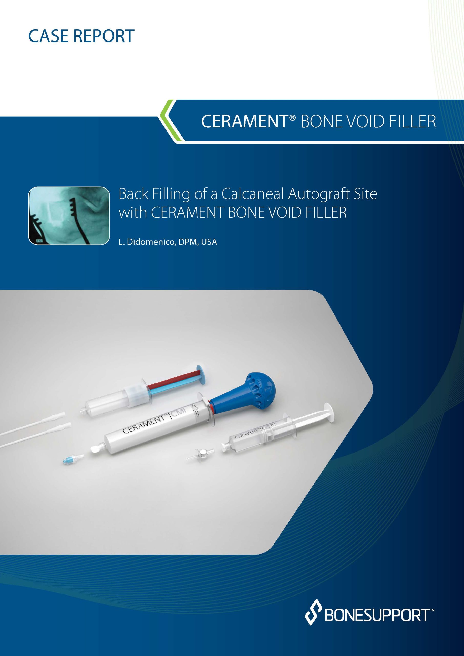 Didomenico Back Filling of a Calcaneal Autograft Site with CERAMENT BONE VOID FILLER