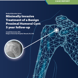 Dr. Benevenia case report: Minimally Invasive Treatment of a Benign Proximal Humeral Cyst: 5 year follow-up