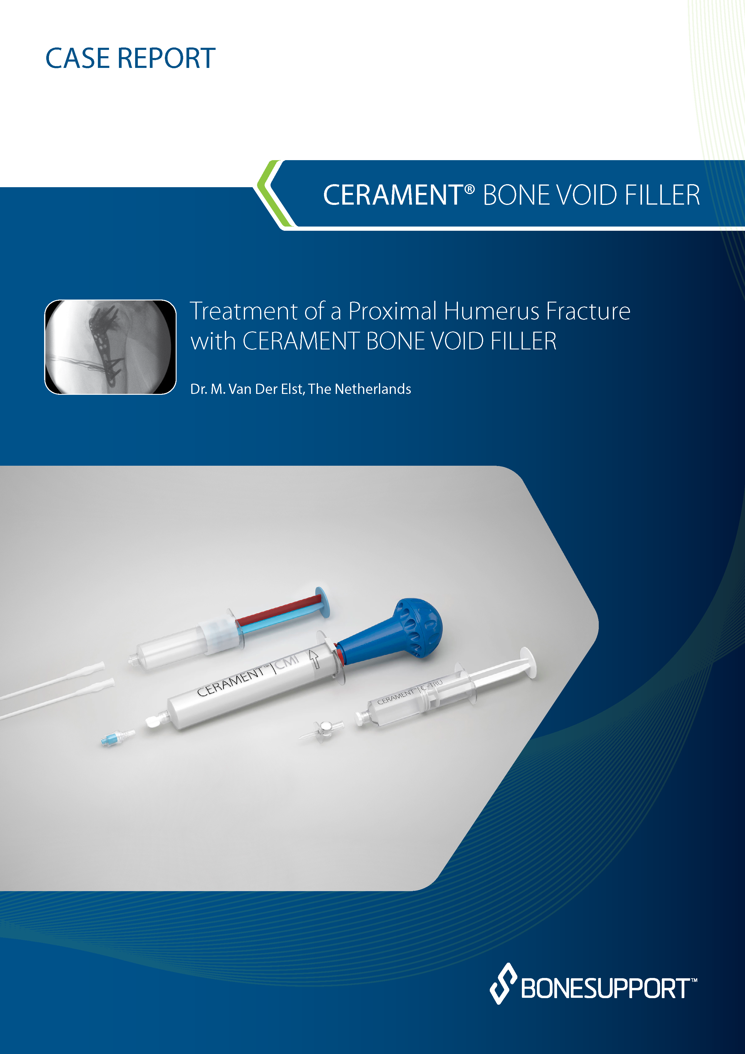 Dr van der Elst Treatment of a proximal humerus fracture with CERAMENT BONE VOID FILLER: 12 months follow-up