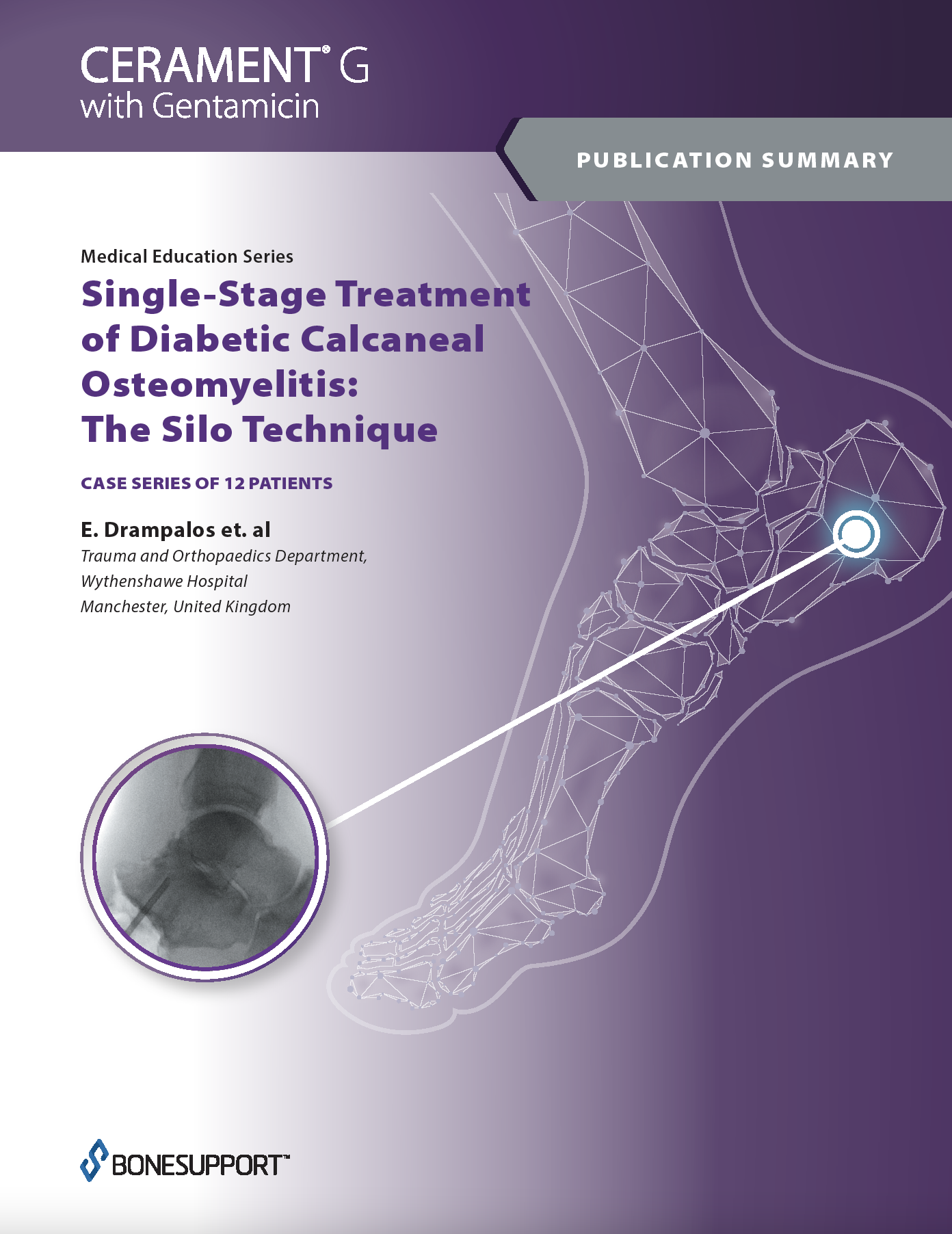 Single-Stage Treatment of Diabetic Calcaneal Osteomyelitis: The Silo Technique