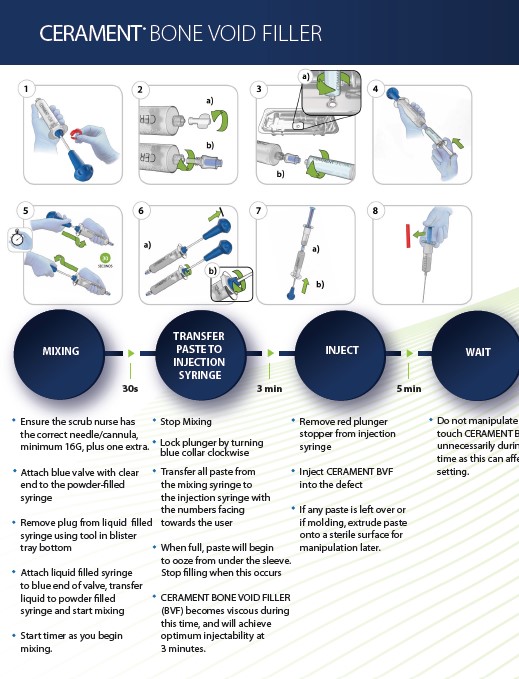 CERAMENT BVF Mixing Tips Guide