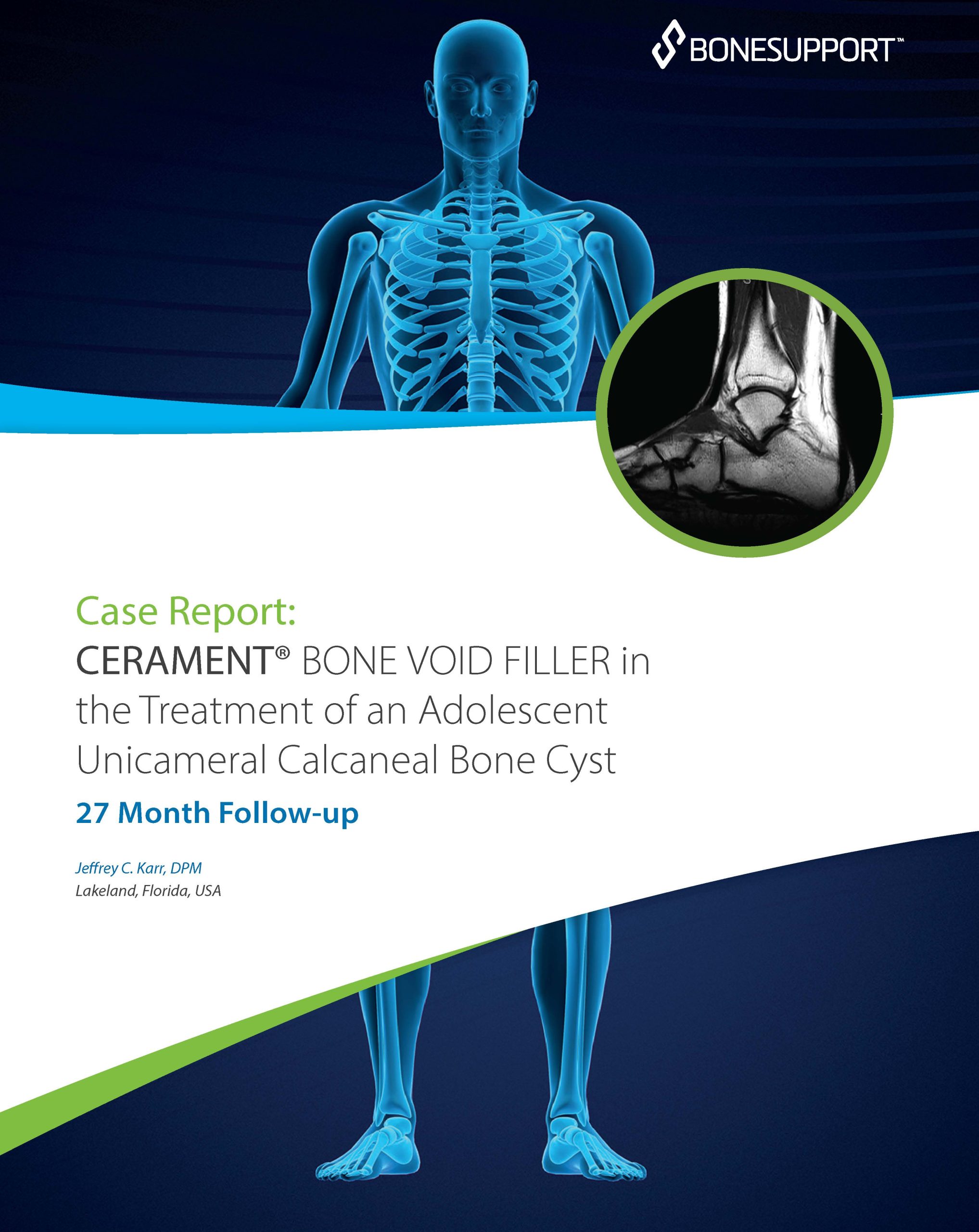 CERAMENT BONE VOID FILLER in the Treatment of an Adolescent Unicameral Calcaneal Bone Cyst 27 Month Follow-up