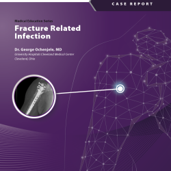 Fracture Related Infection - A CERAMENT G Case Report