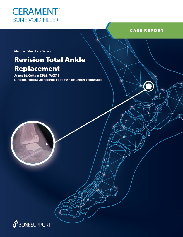 Revision Total Ankle Replacement  James M. Cottom, DMP, FACFAS Director, Florida Orthopedic Foot & Ankle Fellowship