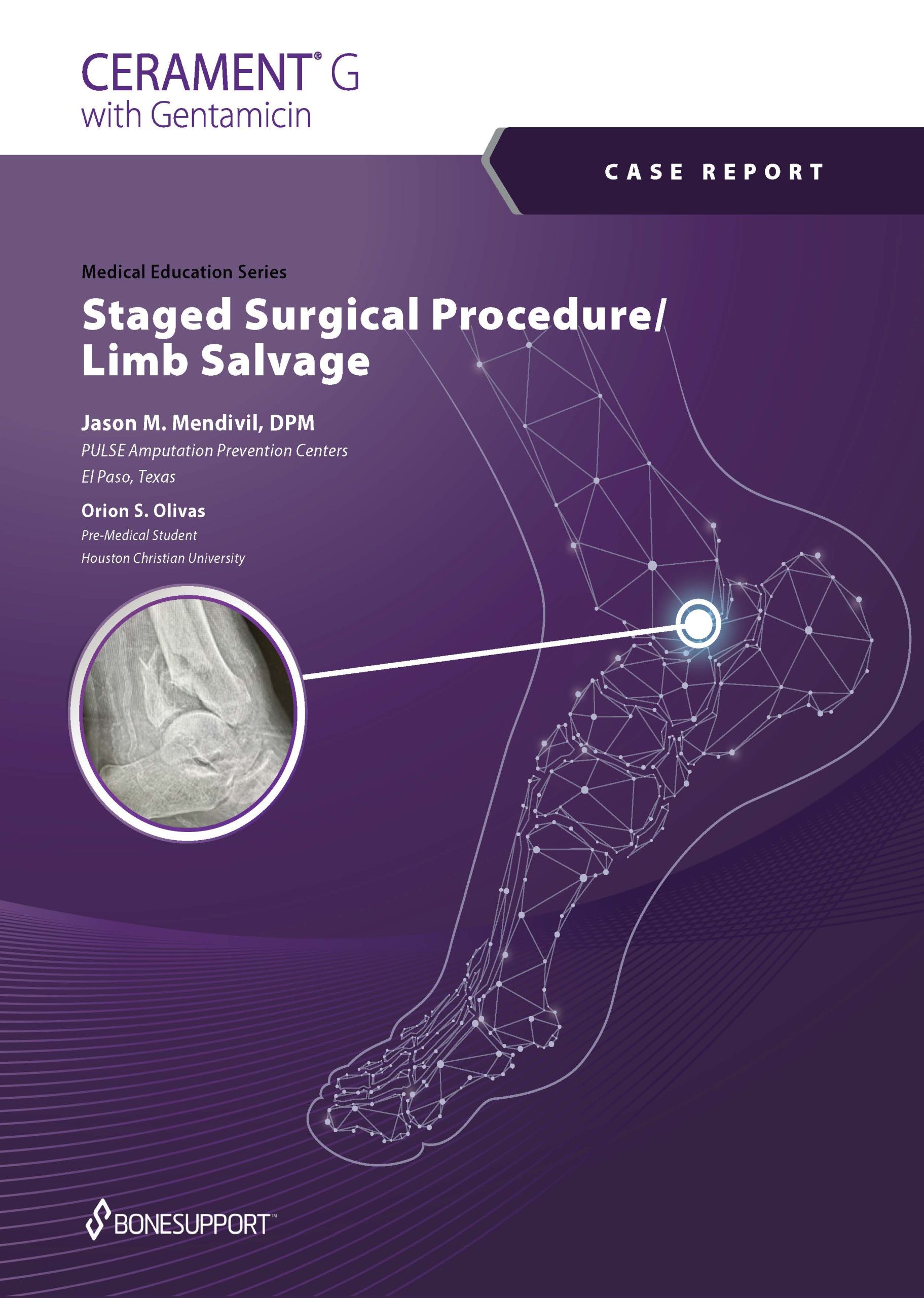 Staged Surgical Procedure/ Limb Salvage