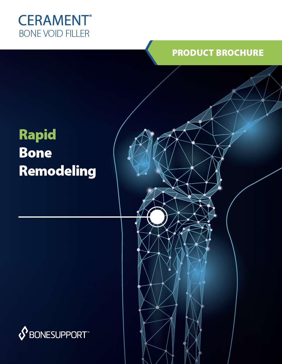 CERAMENT BONE VOID FILLER brochure the next generation of bone substitute